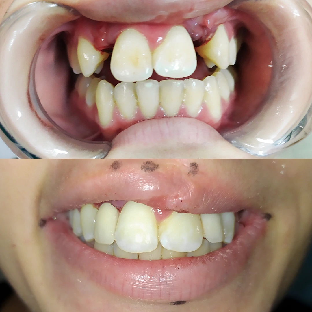 Antes e depois 3